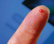 pricked finger