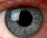 iridology