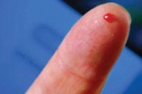 Picture for Errol Denton Harley Street Live Blood Specialist Offers Safe Natural Acne Cure As Opposed To Deadly Roaccutane Drug As Featured On BBC3